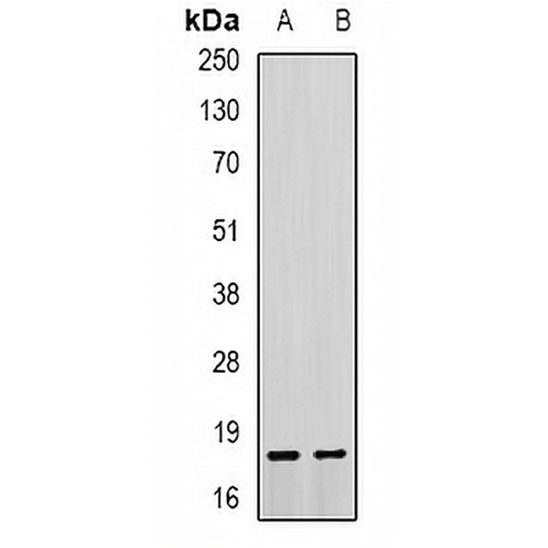 Troponin C Rabbit Polyclonal Antibody