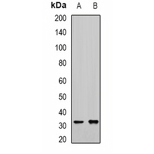 RCAS1 Rabbit Polyclonal Antibody