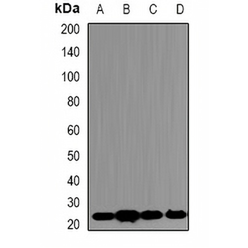 PSMB5 Rabbit Polyclonal Antibody