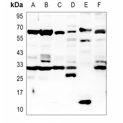 TMPRSS2 Rabbit Polyclonal Antibody