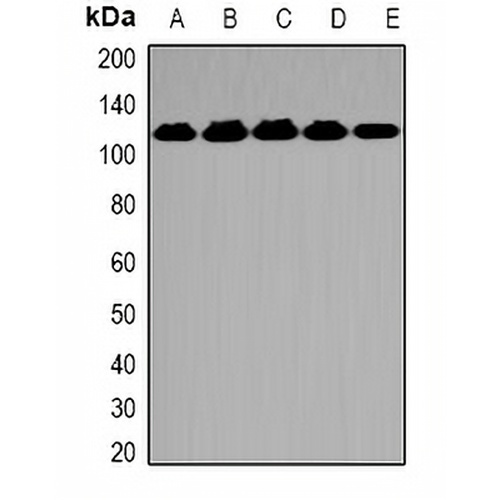 OGT Rabbit Polyclonal Antibody