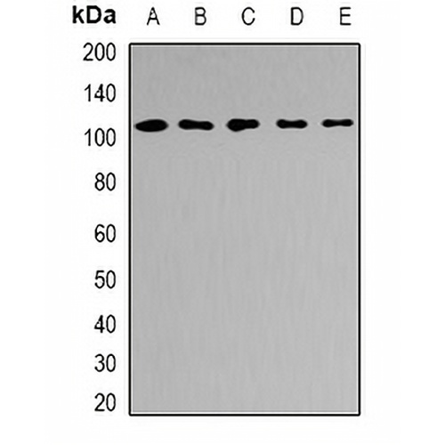 AP2-beta-1 Rabbit Polyclonal Antibody