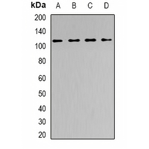 SNF2H Rabbit Polyclonal Antibody