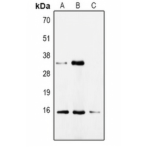 CDA Rabbit Polyclonal Antibody