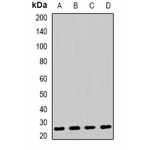 AK4 Rabbit Polyclonal Antibody