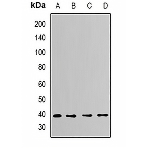 CapZ alpha-2 Rabbit Polyclonal Antibody