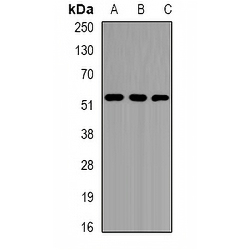 EPHX1 Rabbit Polyclonal Antibody