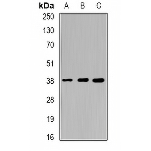 Sorbitol Dehydrogenase Rabbit Polyclonal Antibody