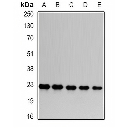 PSMA6 Rabbit Polyclonal Antibody