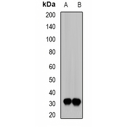 SIAH1 Rabbit Polyclonal Antibody