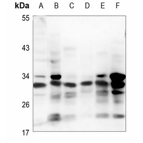 PRG2 Rabbit Polyclonal Antibody