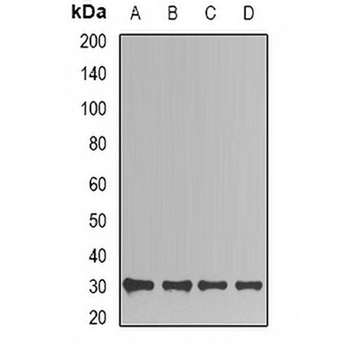 TIM Rabbit Polyclonal Antibody