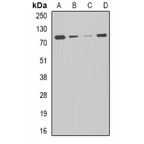 CPT2 Rabbit Polyclonal Antibody