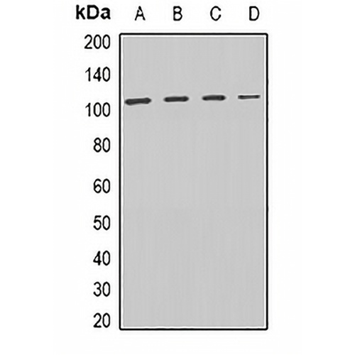 DISC-1 Rabbit Polyclonal Antibody