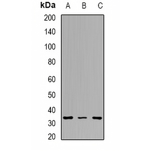 Tropomyosin 2 Rabbit Polyclonal Antibody