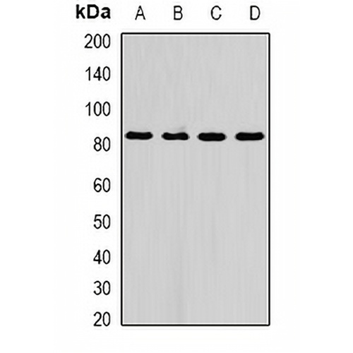 AFAP1 Rabbit Polyclonal Antibody