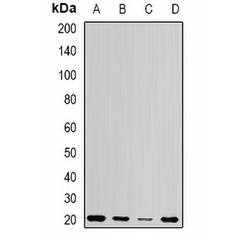 Centrin-1 Rabbit Polyclonal Antibody