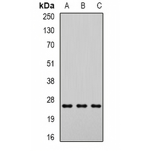 DCXR Rabbit Polyclonal Antibody