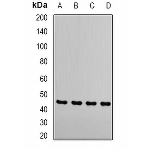 RRM2 Rabbit Polyclonal Antibody