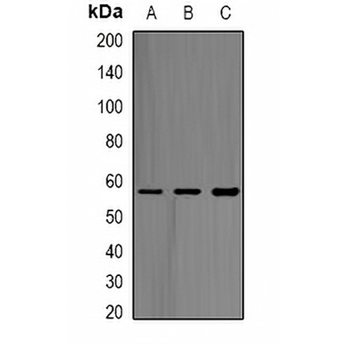 ABAT Rabbit Polyclonal Antibody