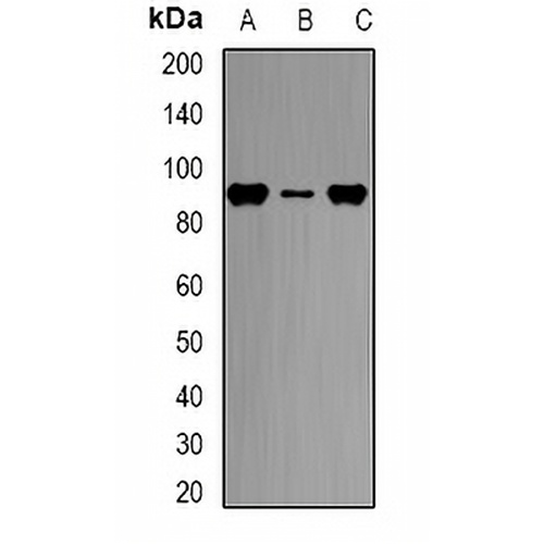 CPT1A Rabbit Polyclonal Antibody