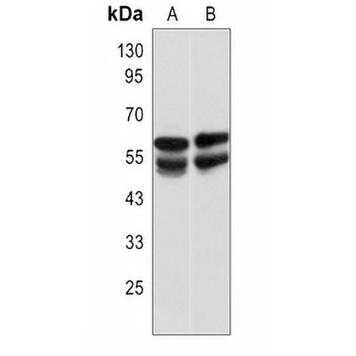 IRSp53 Rabbit Polyclonal Antibody