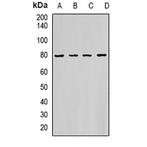 HADHA Rabbit Polyclonal Antibody