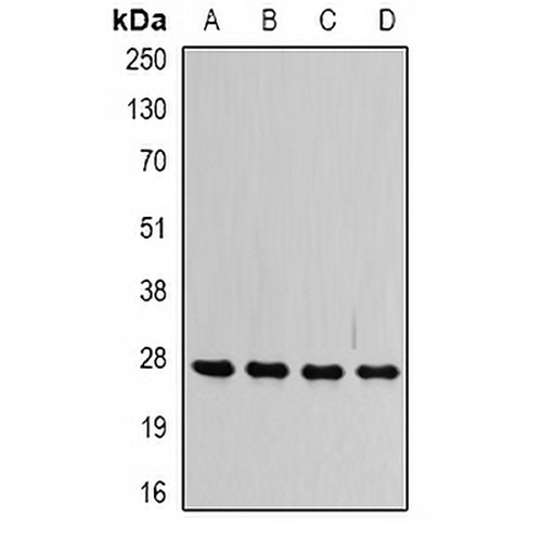 VAP-B/C Rabbit Polyclonal Antibody