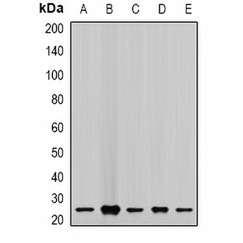 CHMP2B Rabbit Polyclonal Antibody