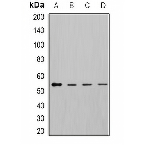 DLD Rabbit Polyclonal Antibody