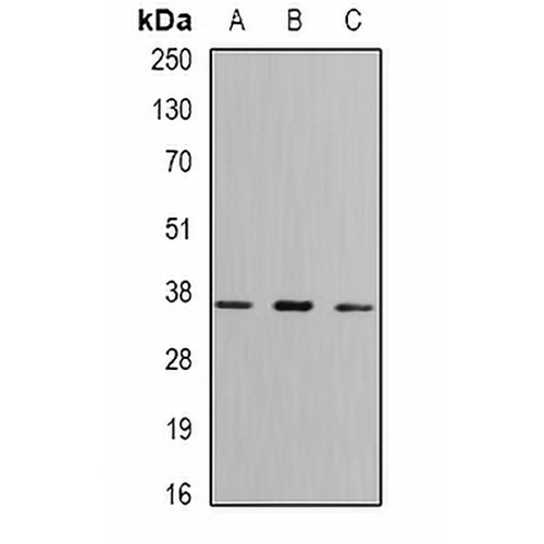 FBP1 Rabbit Polyclonal Antibody