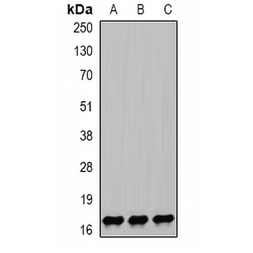 NPC2 Rabbit Polyclonal Antibody