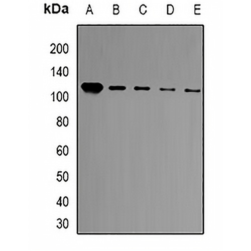 BCL11A Rabbit Polyclonal Antibody