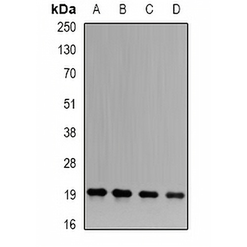 APRT Rabbit Polyclonal Antibody