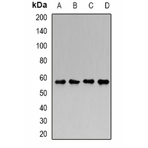 Chondroitinase Rabbit Polyclonal Antibody