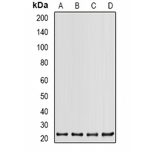 PSMB2 Rabbit Polyclonal Antibody