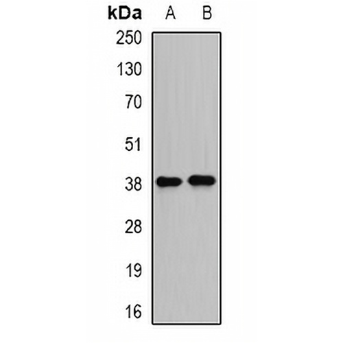 DDA3 Rabbit Polyclonal Antibody