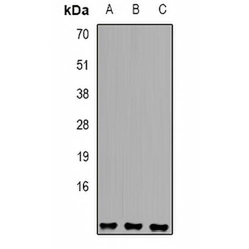 Sm E Rabbit Polyclonal Antibody