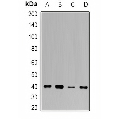 UROD Rabbit Polyclonal Antibody