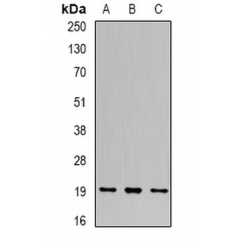 UBE2C Rabbit Polyclonal Antibody