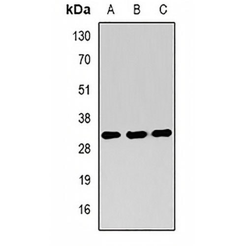 RING1b Rabbit Polyclonal Antibody
