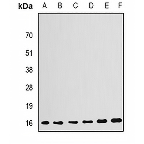 GABARAP Rabbit Polyclonal Antibody