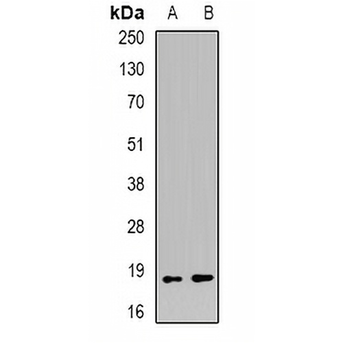 EVI1 Rabbit Polyclonal Antibody