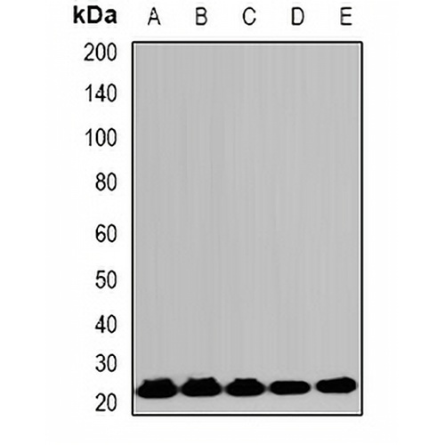 HPRT Rabbit Polyclonal Antibody