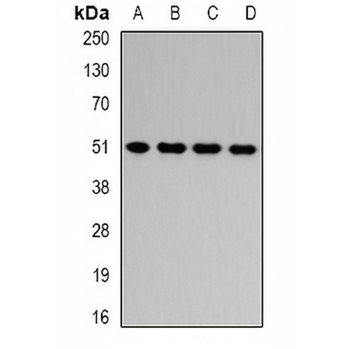 HADHB Rabbit Polyclonal Antibody