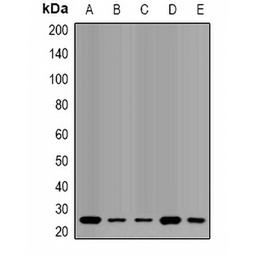 QDPR Rabbit Polyclonal Antibody