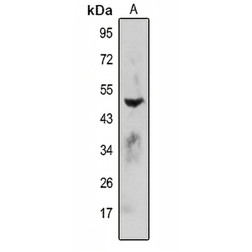 FDPS Rabbit Polyclonal Antibody