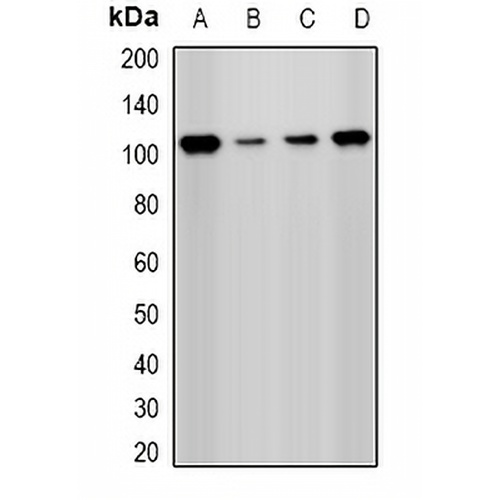 PHC1 Rabbit Polyclonal Antibody