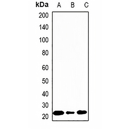 DCTD Rabbit Polyclonal Antibody