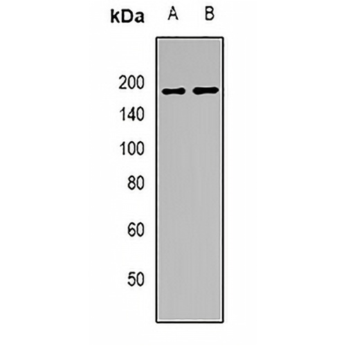 GW182 Rabbit Polyclonal Antibody